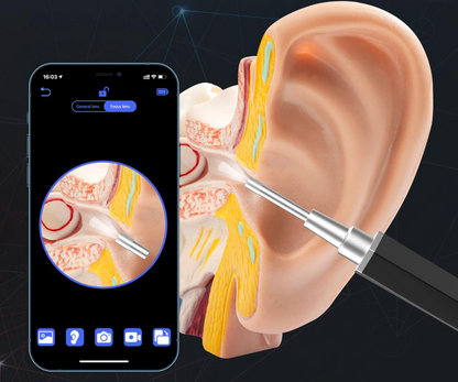 Ear Camm® l Limpiador De Oidos